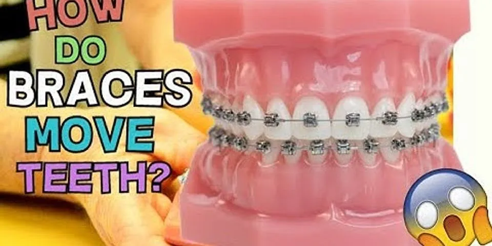 Which teeth move first with braces